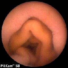 Normal small bowel capsule image